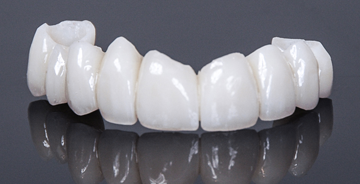 Restaurations Oral-Temp<sup>®</sup>